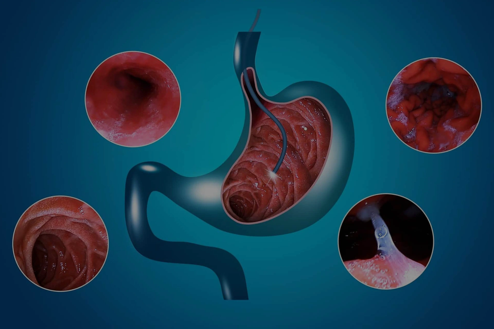 best gastro care by dr rakesh chava
